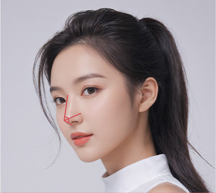 nose thread lift in Korea PangPang Clinic Gangnam 