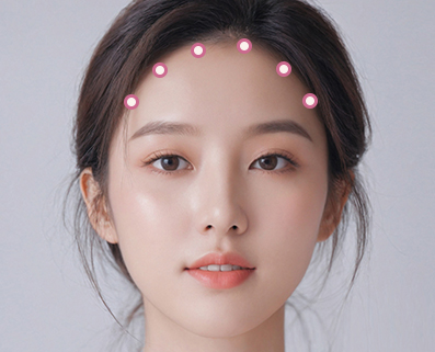 forehead eyebrow thread lift in Korea PangPang Clinic gangnam