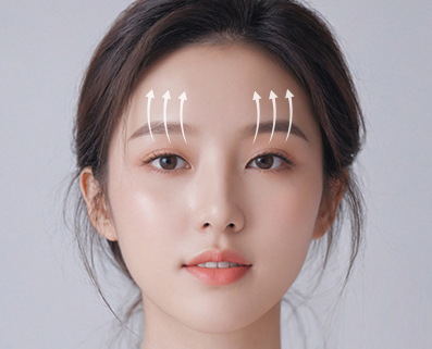 forehead eyebrow thread lift in Korea PangPang Clinic gangnam