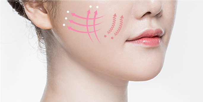 smile line thread lift in Korea PangPang Clinic gangnam