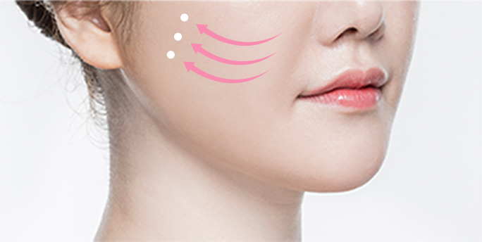 smile line thread lift in Korea PangPang Clinic gangnam