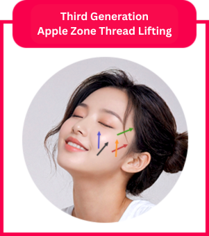 mid face thread lift in Korea PangPang Clinic gangnam