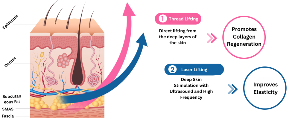 thread lifting in Korea Pangpang clinic Gangnam