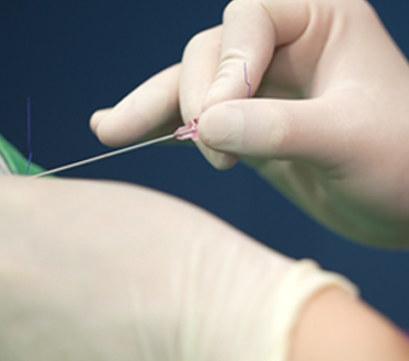 thread lifting in Korea Pangpang clinic Gangnam