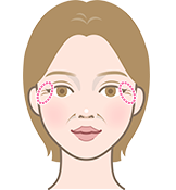 thread lifting in Korea Pangpang clinic Gangnam