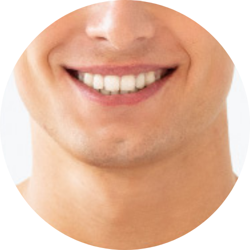 male thread lift in Korea pangpang clinic Seoul gangnam