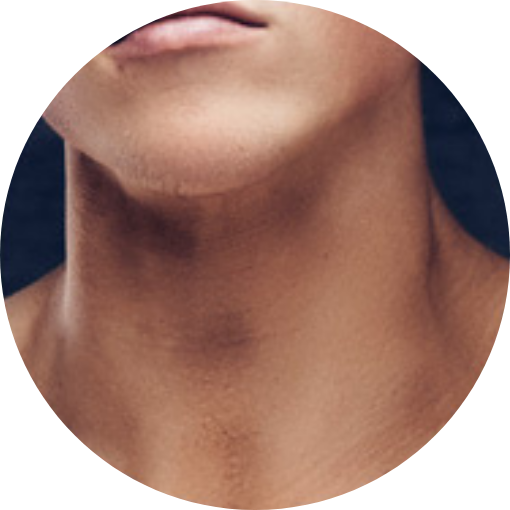 male thread lift in Korea pangpang clinic Seoul gangnam