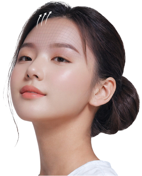 forehead eyebrow thread lift in Korea PangPang Clinic gangnam